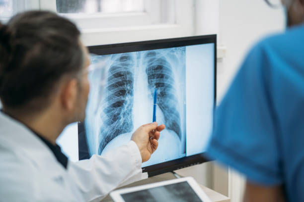 Best Doctor For Lung Cancer/Lung Fibrosis in Borivali